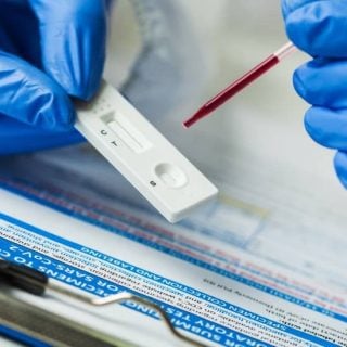 Rapid Antigen Test